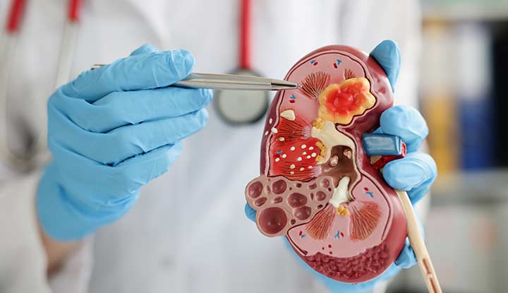 Nephrology Department
